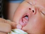 bibir anak jamuran