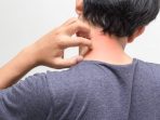 Alkohol Bisa Bikin Badan Gatal gatal Ini Sebabnya