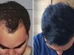 rambut 1