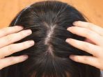 rambut beruban rambut beruban