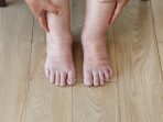 kaki bengkak kaki bengkak